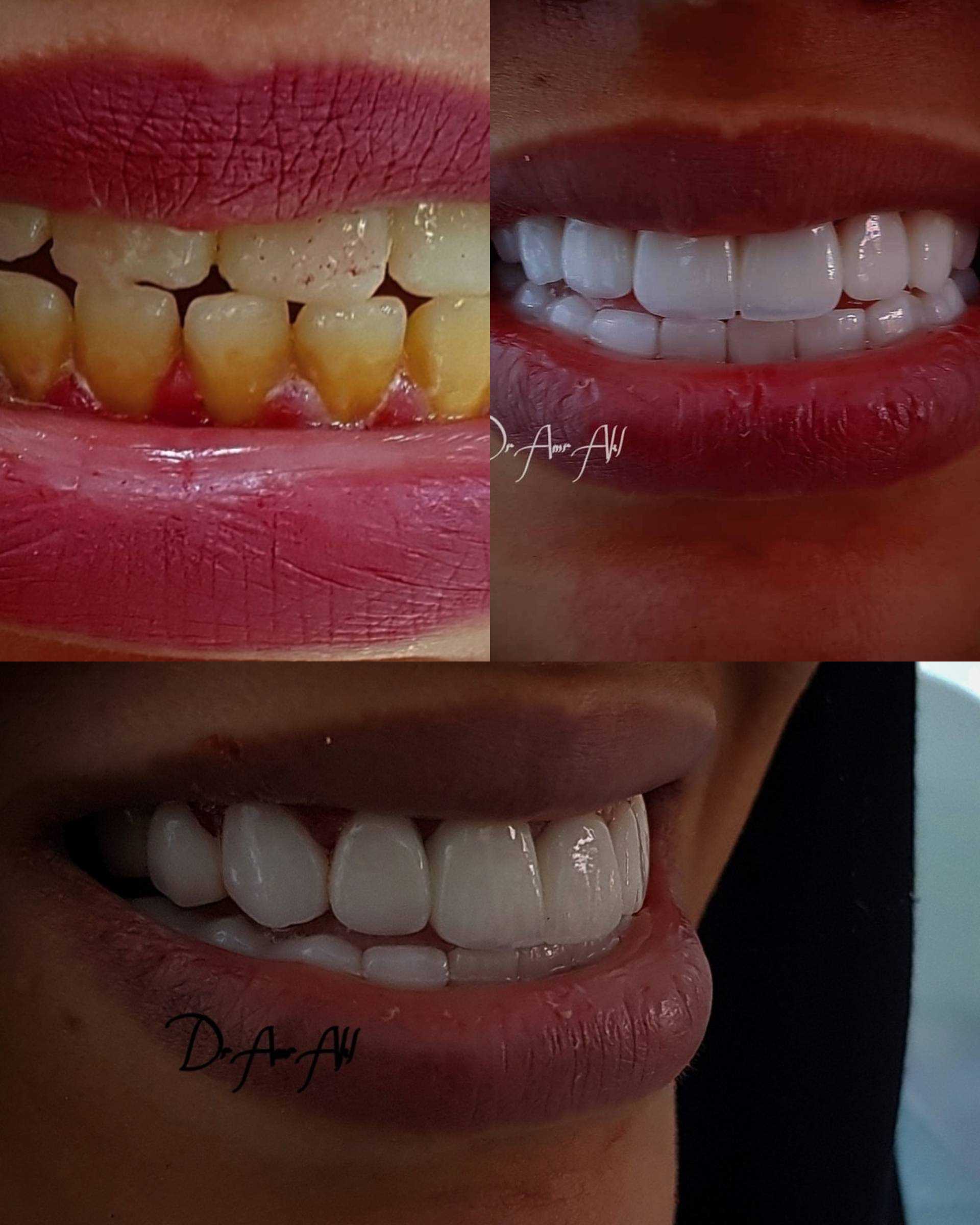 Image Gallary  Dr Albert wahib   Smile and Shine Dental clinic