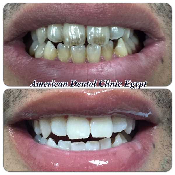 Image Gallary  Clinic  American Dental Dr Ahmed Bakry