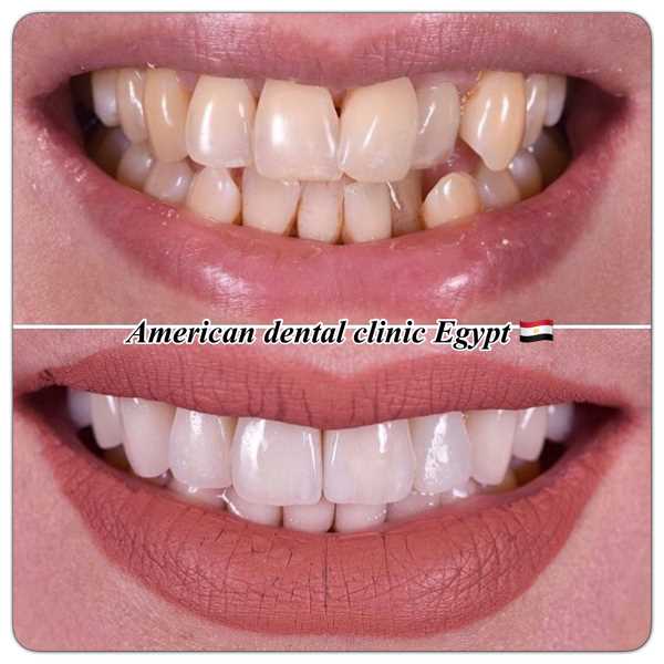 Image Gallary  Clinic  American Dental Dr Ahmed Bakry