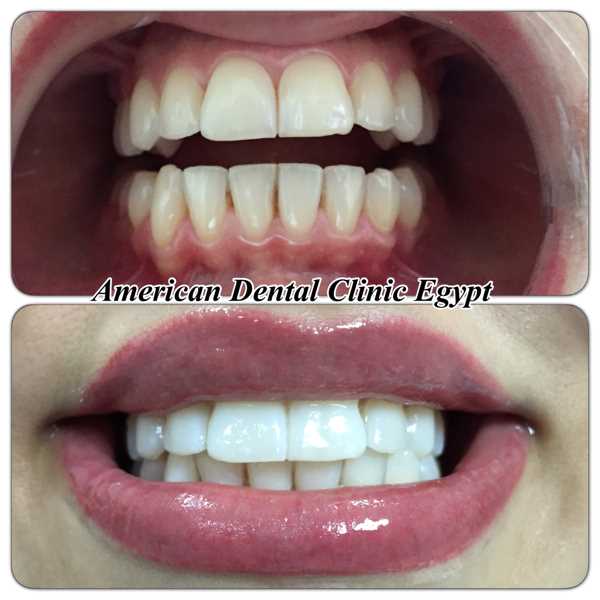 Clinic  American Dental Dr Ahmed Bakry