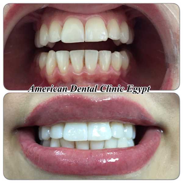 Image Gallary  Clinic  American Dental Dr Ahmed Bakry