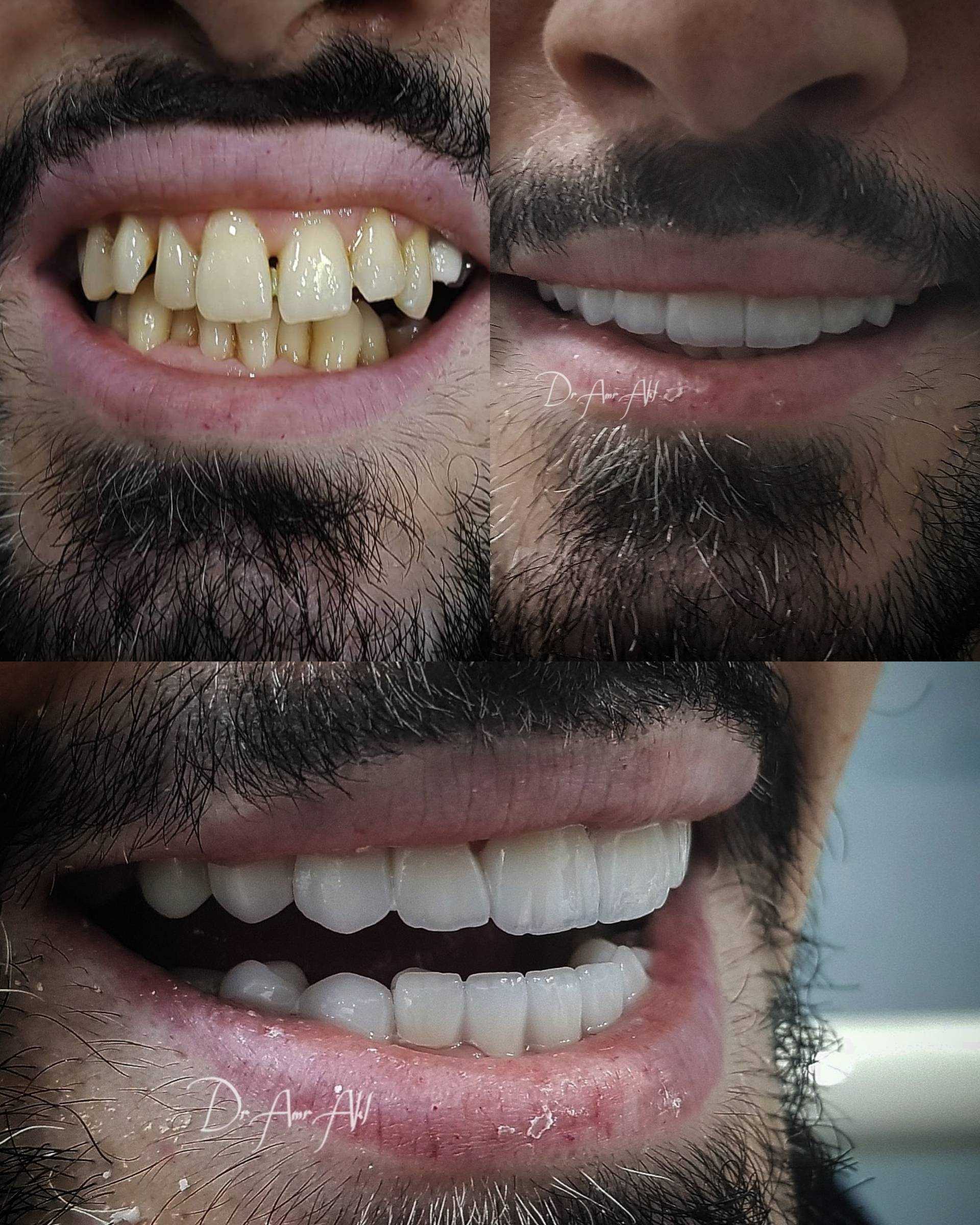 Image Gallary  Dr Albert wahib   Smile and Shine Dental clinic